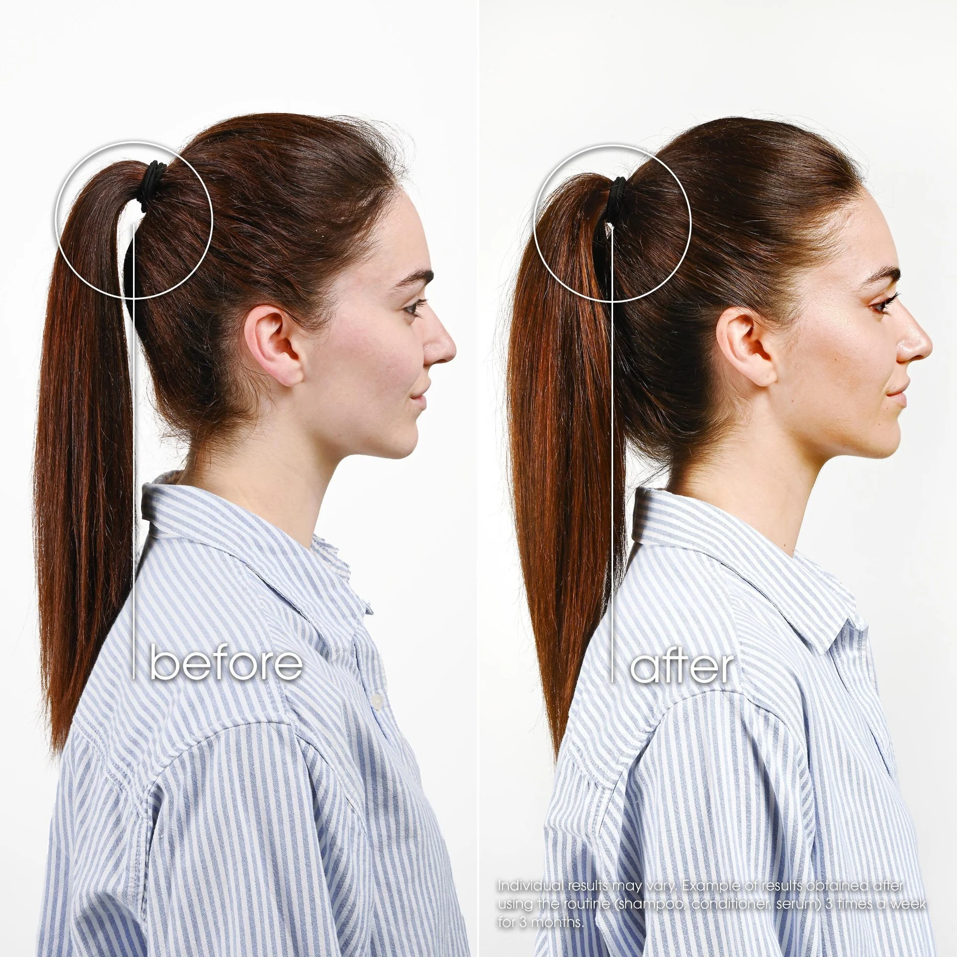 Klorane Anti-Hair Loss Serum - 100ml - Image 4
