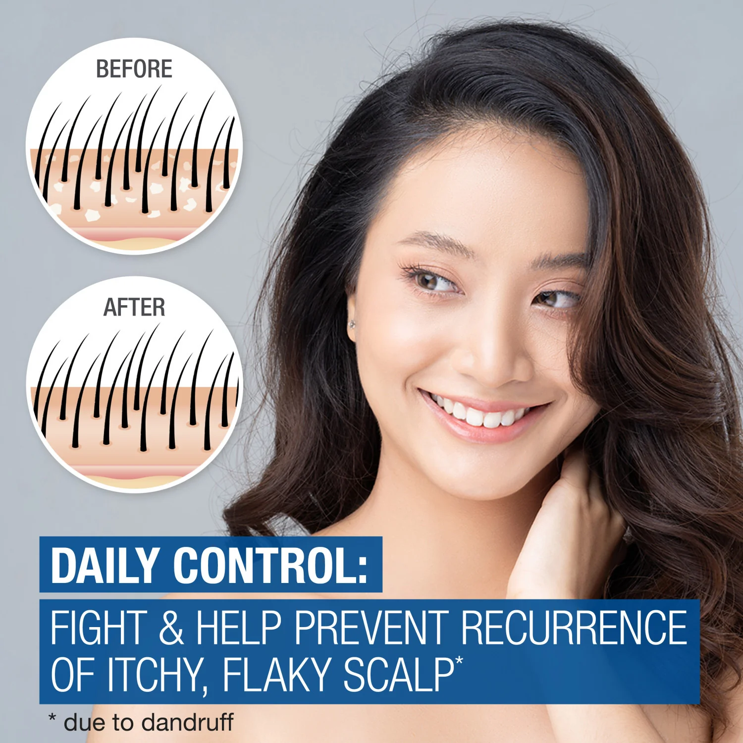 Neutrogena Scalp Therapy Anti-Dandruff Shampoo Daily Control 12 oz - Image 2