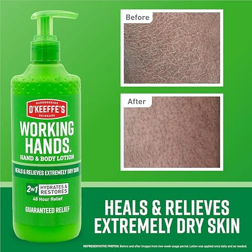 O'Keeffe's Working Hands Lotion for Dry Skin 12oz - Image 2