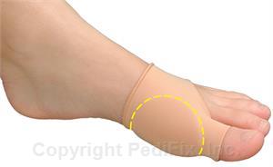 PediFix Visco-GEL Bunion Relief Sleeve - Image 2