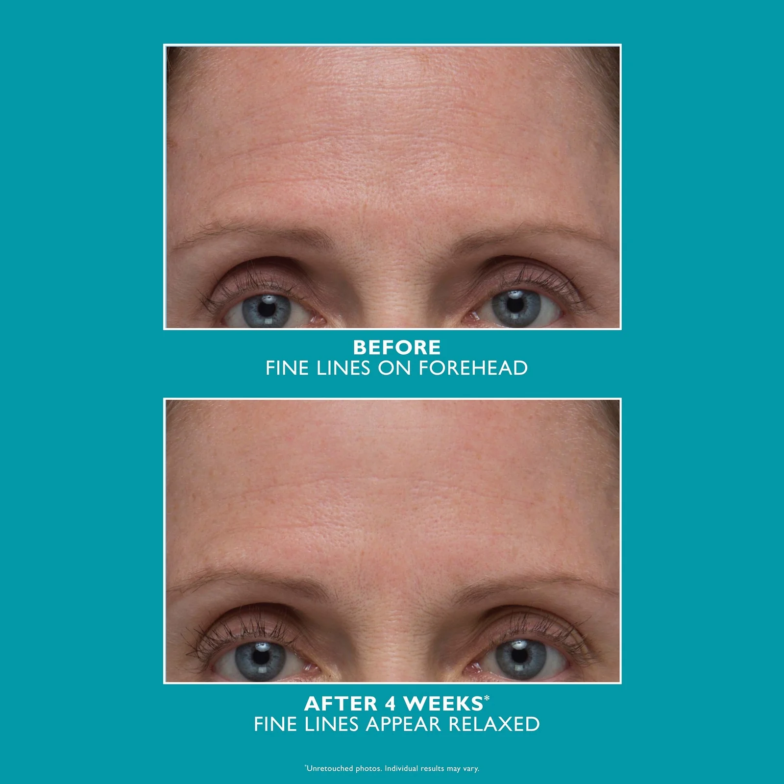 Peter Thomas Roth Peptide Skinjection™ Amplified Wrinkle-Fix Serum Refillable Intensive Firming Serum for Instant Smoothing of Wrinkles Refillable 3 - Image 4